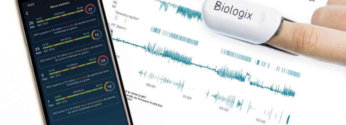 Exame do Sono Biologix (Apneia do Sono)